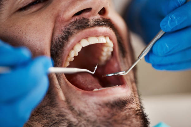 Best Emergency Dental Care for Trauma or Injury in Goldsby, OK