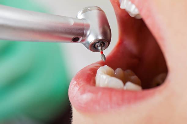 Best Emergency Dental Surgery in Goldsby, OK